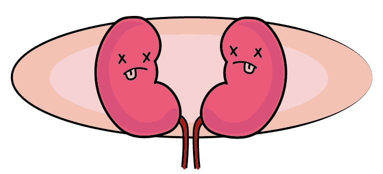 An illustration of two failed kidneys 